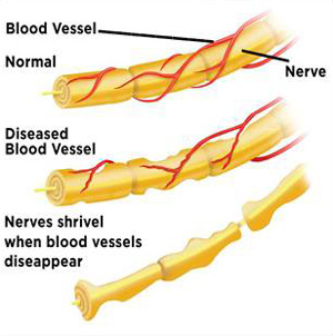 veins diagram